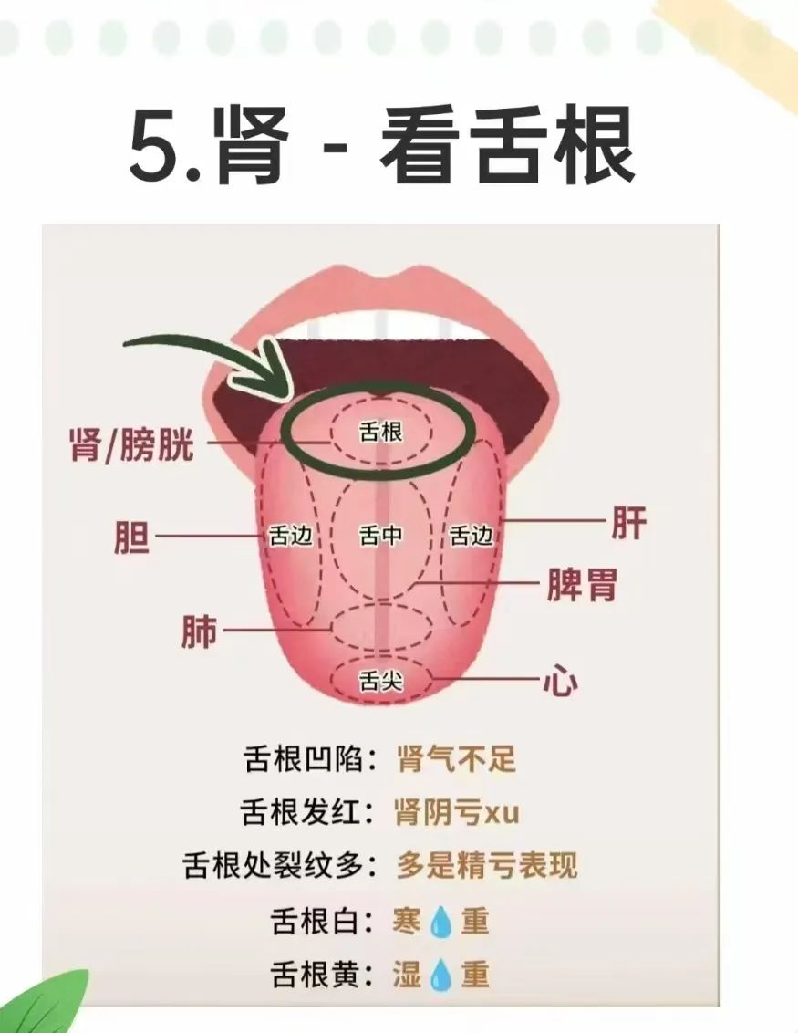Tongue Diagnosis and the Five Organs