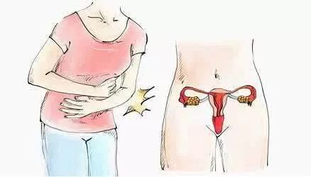 5 Key Indicators to Self-Test for Blood Stasis