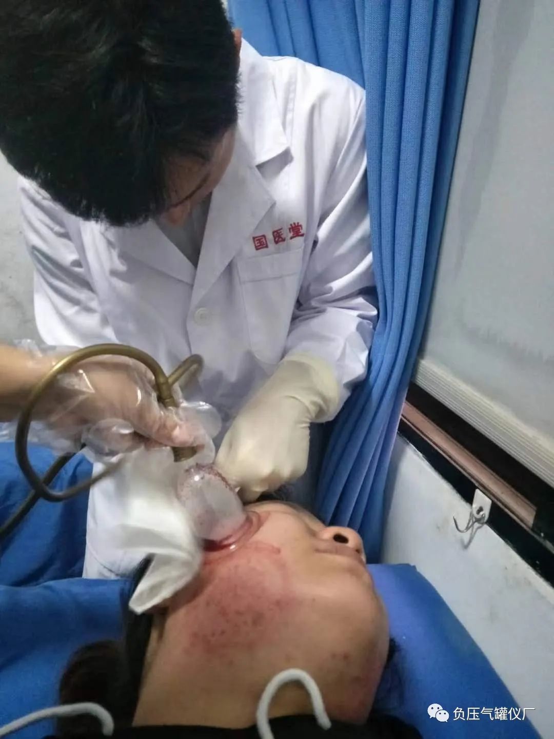 Common Sites, Techniques, and Diagnosis of Bloodletting in TCM