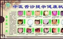 Understanding Tongue Diagnosis in Traditional Chinese Medicine (with Tongue Diagnosis Illustrations)