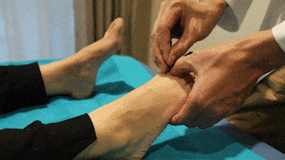 Comprehensive Guide to Acupuncture Techniques: A Lifelong Benefit of Traditional Chinese Medicine!