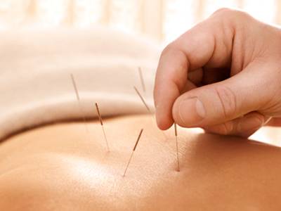 Ten Common Cupping Therapy Techniques