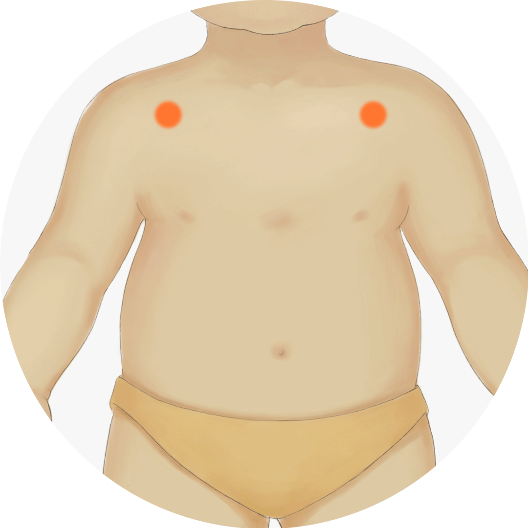 Differentiating Coughs: Cold, Heat, and Dryness for Effective Treatment