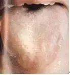 Comprehensive Guide to Tongue Diagnosis: Learn How Your Tongue Reflects Your Health!