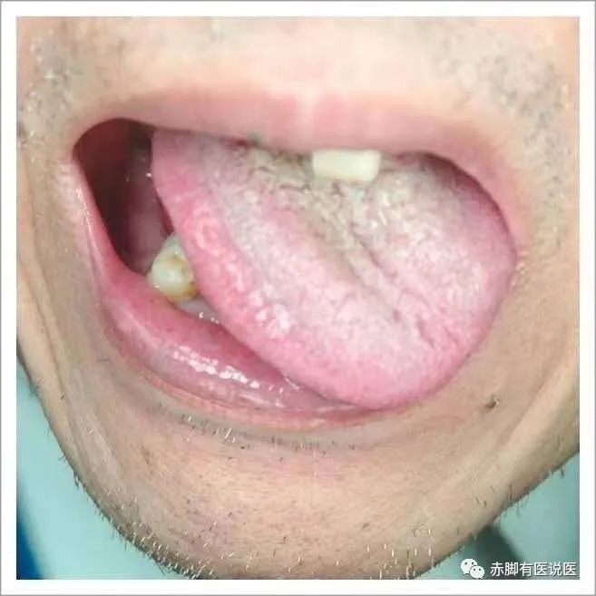 Understanding Your Tongue Diagnosis in 10 Minutes