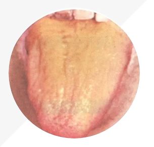 Analysis of High-Definition Tongue Diagnosis Charts: Understanding Health Through Your Tongue (Part 1)