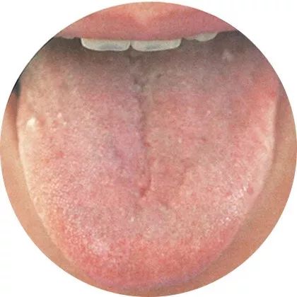The Most Comprehensive High-Definition Real Tongue Diagnosis: Observing Tongue Patterns to Understand Internal Organs (Collection Edition)