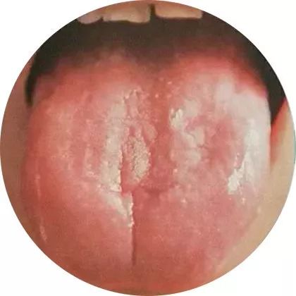 Comprehensive Guide to Tongue Diagnosis: A Must-Collect!