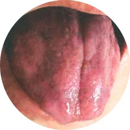 The Most Comprehensive High-Definition Real Tongue Diagnosis: Observing Tongue Patterns to Understand Internal Organs (Collection Edition)