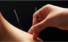 Acupuncture Techniques (A Must-Read for Acupuncturists)