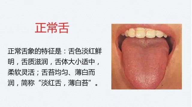 The Most Comprehensive TCM Tongue Diagnosis Atlas: Observe the Tongue, Understand the Whole Body!