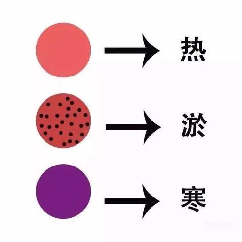 Cupping Therapy Techniques in Traditional Chinese Medicine