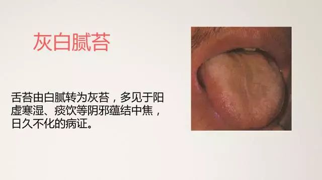 The Most Comprehensive TCM Tongue Diagnosis Atlas: Observe the Tongue, Understand the Whole Body!