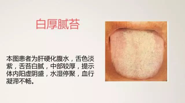 The Most Comprehensive TCM Tongue Diagnosis Atlas: Observe the Tongue, Understand the Whole Body!