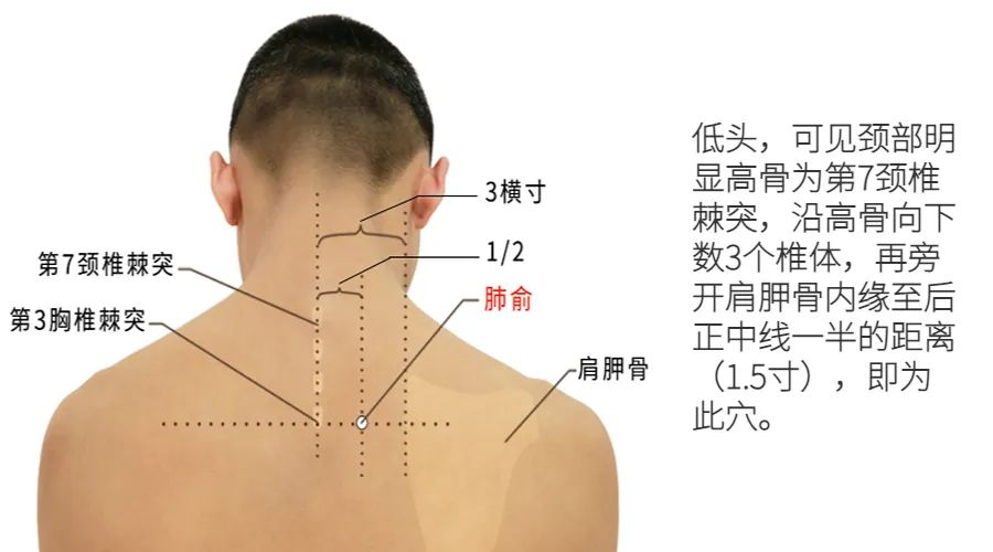 Phlegm-Dampness: Effectively Clear Lung Phlegm with One Acupuncture Point, Eliminating White, Yellow, and Sticky Phlegm