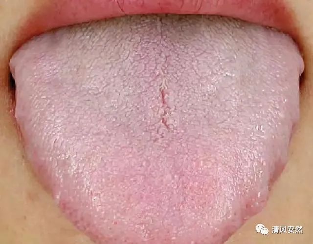 Always Short of Breath and Lethargic? Here's How to Nourish Qi Deficiency in Three Simple Steps!