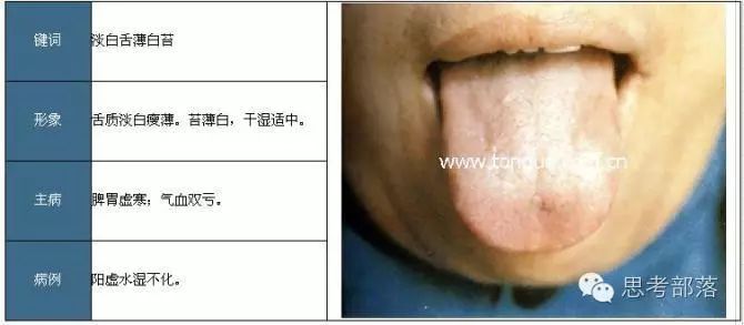 Comprehensive Guide to Tongue Diagnosis (8): 72 Types of Tongue Diagnosis Charts