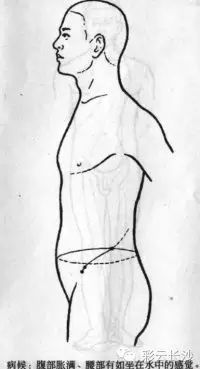 Classic Acupuncture Points: The Eight Extraordinary Meridians