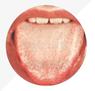 Understanding Tongue Diagnosis in TCM: Insights into Health from Tongue Appearance (Part 2)