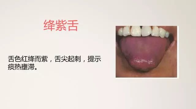 The Most Comprehensive TCM Tongue Diagnosis Atlas: Observe the Tongue, Understand the Whole Body!