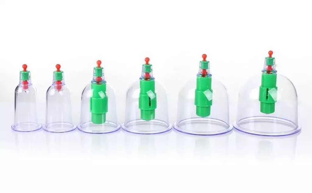 The Marvelous Cupping Therapy in Traditional Chinese Medicine: Many Benefits, but Not for Everyone!