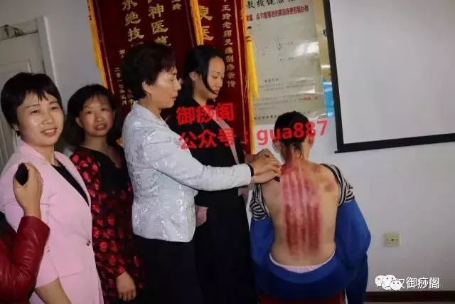 Why Gua Sha Should Not Be Limited to the Back: The Wonders of Gua Sha