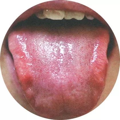 The Most Comprehensive High-Definition Real Tongue Diagnosis: Observing Tongue Patterns to Understand Internal Organs (Collection Edition)