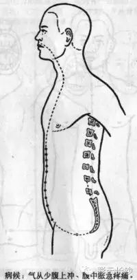 Classic Acupuncture Points: The Eight Extraordinary Meridians