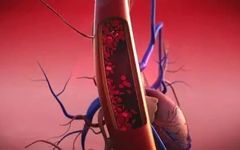 Stasis of Blood as the Root of All Illness: Six Signs Indicating Blood Stasis in Your Body