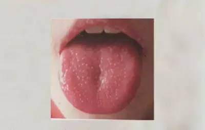 Exploring the Secrets of the Body Through Tongue Diagnosis