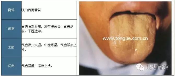 Comprehensive Guide to Tongue Diagnosis (8): 72 Types of Tongue Diagnosis Charts