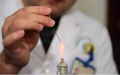 Understanding Fire Needle Therapy in Traditional Chinese Medicine