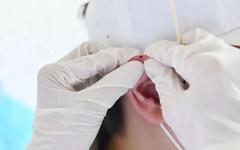 Ear Apex Bloodletting Therapy in Traditional Chinese Medicine