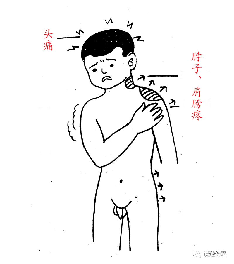 Are You Suffering from Wind-Cold or Wind-Heat Cold? If You Can't Distinguish, Use This!