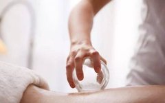 Cupping Therapy: A Traditional Chinese Medicine Approach to Health