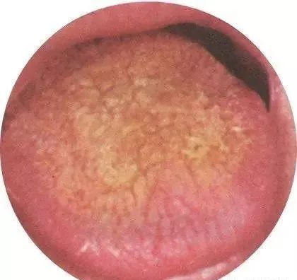 130 High-Definition Tongue Diagnosis Charts (Recommended for Collection)
