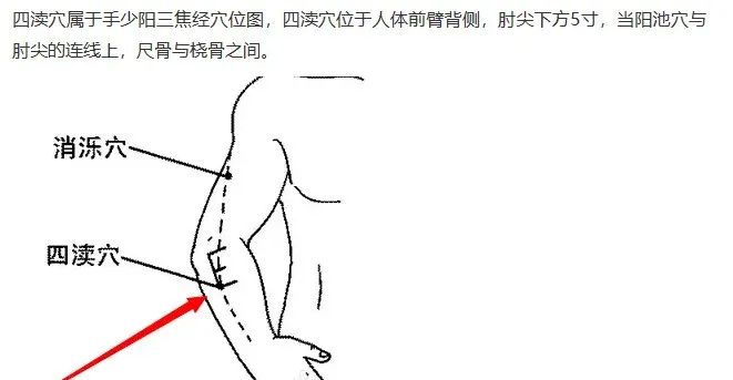 Three Acupuncture Points for Activating Blood Circulation and Resolving Stasis