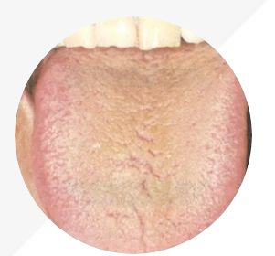 Analysis of High-Definition Tongue Diagnosis Charts: Understanding Health Through Your Tongue (Part 1)