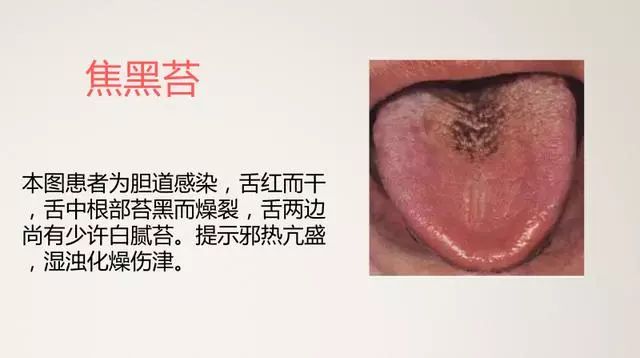 The Most Comprehensive TCM Tongue Diagnosis Atlas: Observe the Tongue, Understand the Whole Body!