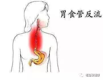 Dysphagia: Five Methods to Alleviate Esophageal Obstruction