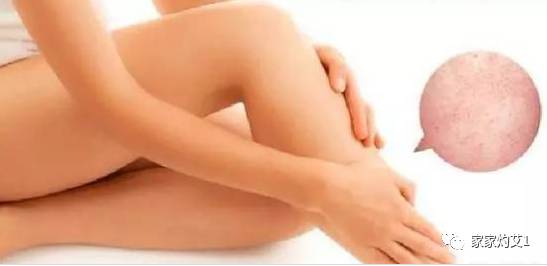 Strengthening the Vital Qi and Expelling Pathogenic Qi: How Moxibustion in TCM Can Help You Heal!