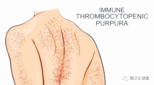 Symptoms of Blood Stasis and TCM Differentiation and Treatment