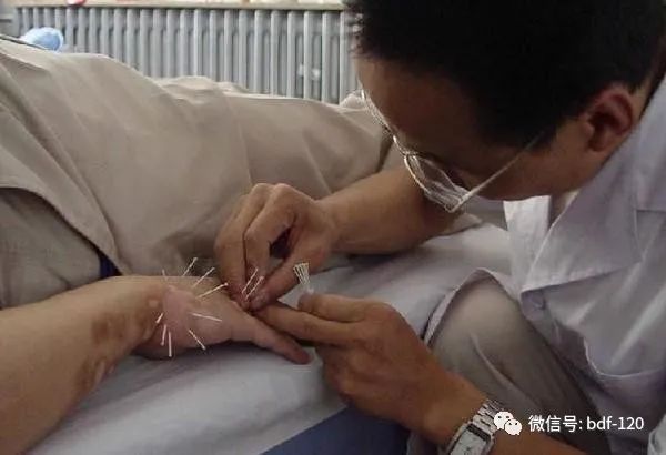 External Treatment Methods of Traditional Chinese Medicine for Vitiligo