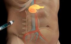 Reliable Dietary Therapies for Diabetes (Worth Collecting)