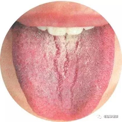 Learn Quick Ways to Observe Tongue Quality and Coating to Understand Your Health and Diseases!