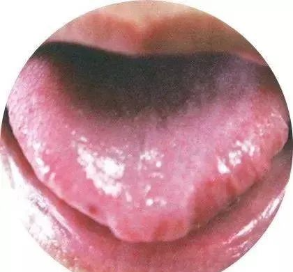 130 High-Definition Tongue Diagnosis Charts (Recommended for Collection)