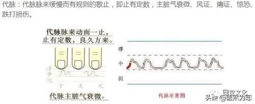 Understanding Pulse Patterns: Xu Mai, Wei Mai, Xi Mai, Dai Mai, and Duan Mai Explained for Everyone