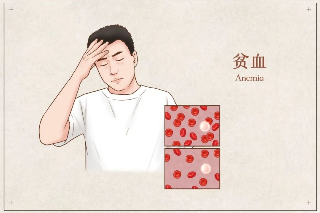 Important Considerations for Blood Nourishment in Autumn: Distinguishing Between Anemia and Blood Deficiency
