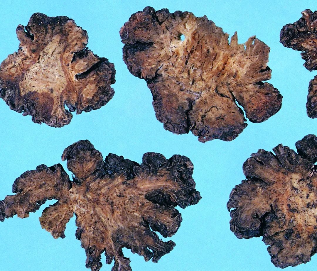Understanding the Qi-Invigorating Properties of Chuanxiong (Ligusticum chuanxiong)