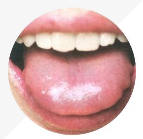 Understanding Tongue Diagnosis in TCM: Insights into Health from Tongue Appearance (Part 2)